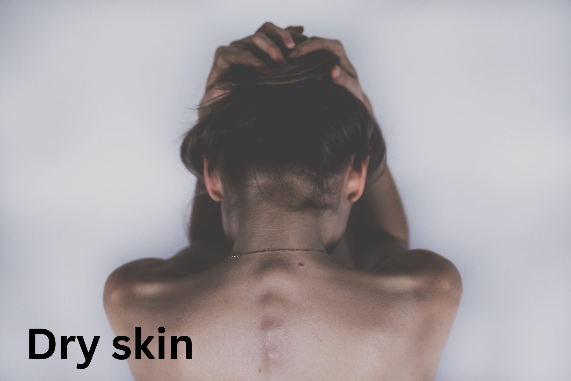 Dry skin, symptoms, causes, types and treatment